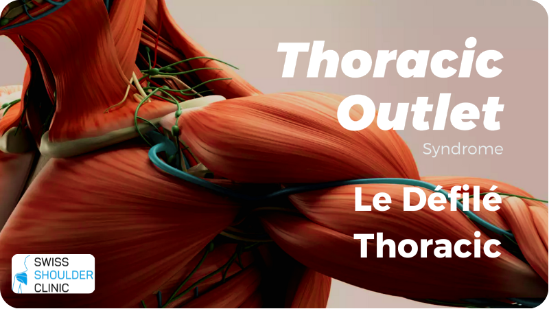 Défilé thoracique (TOS)